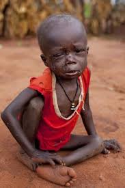 Malnourished Sudanese kid at the Yida refugee camp Yida, South Sudan.
